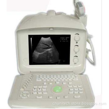 Portable Ultrasound Scanner UNT-135
